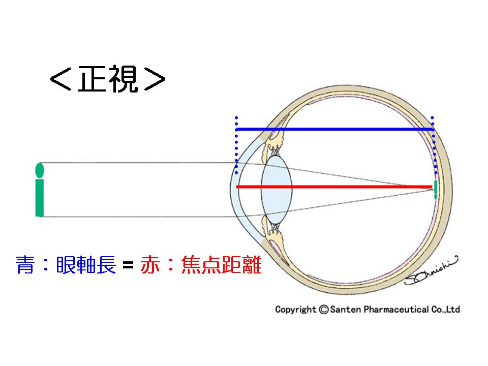 眼に影が見える _ 目 丸い影が見える – QDHN