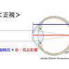 子供の視力１　近視の進行とその予防2020