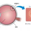 網膜に画像を投影するメガネ