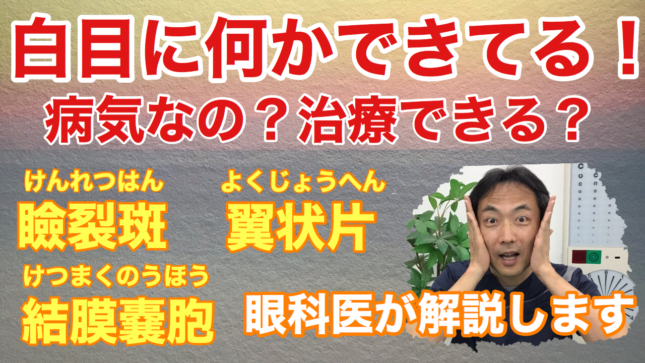 動画 白目に何かできている！これって病気？瞼裂斑と翼状片、結膜のう胞の話