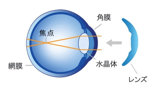 東戸塚 眼科 片桐眼科クリニック オルソケラトロジー 就寝前　眼球イメージ