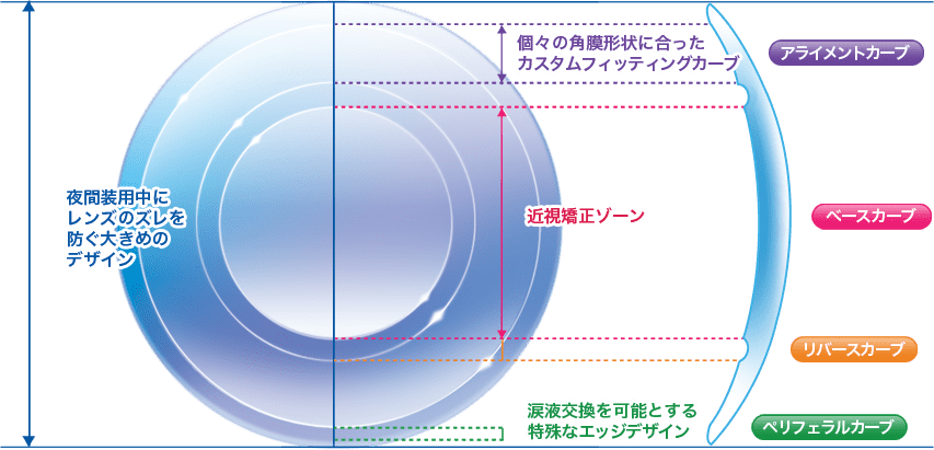 東戸塚 眼科 片桐眼科クリニック オルソケラトロジー マイエメラルドのレンズデザイン