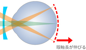 東戸塚 眼科 片桐眼科クリニック 眼鏡による矯正